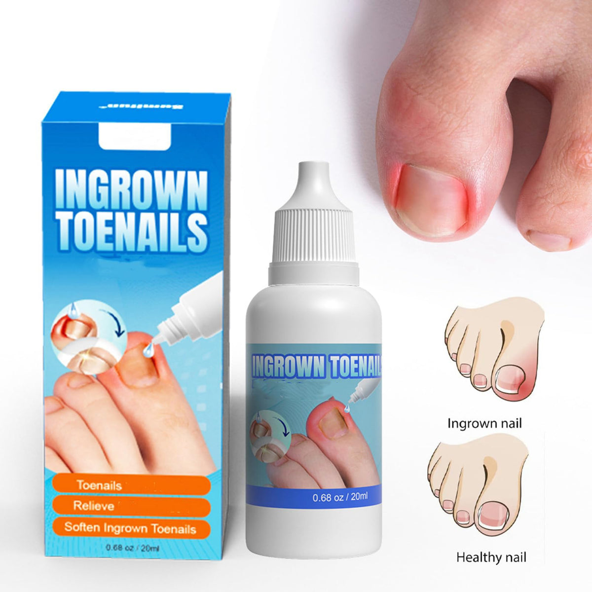 ASMAYSA Ingrown Toenail Correction Extra Strong - Ingrown Toenail Drop- Cuticle Care Oil for Ingrown Toenails - Trimming Toenail Softening Drop Ingrown Toenail Correction,20ml