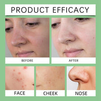 Oumun Relief Mud Mask,Recovery Mud Mask,Body Mud Cleanser Face & Body Ma-sk,Peel Ma-sk,Fa-ce Ma-sk,Glass Skin Hydrating Ma-sk,Fa-ce Masks Skincare,Clay Mask,Pe-el off Fa-ce Masks,Mud Ma-sk for Fa-ce