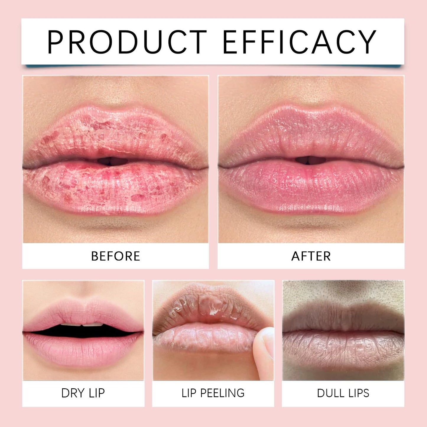 Xunzhi 2PCS Spicule Plumping Lip Shot,Lip Plumper Extreme,Lip Plumping L/i/p Gloss Clear,L/ip Plu/mping Serum,L/ip Plump Lipstick,Plum/ping Li/p Oil,Liquid Microneedling Plum/per Enhancer