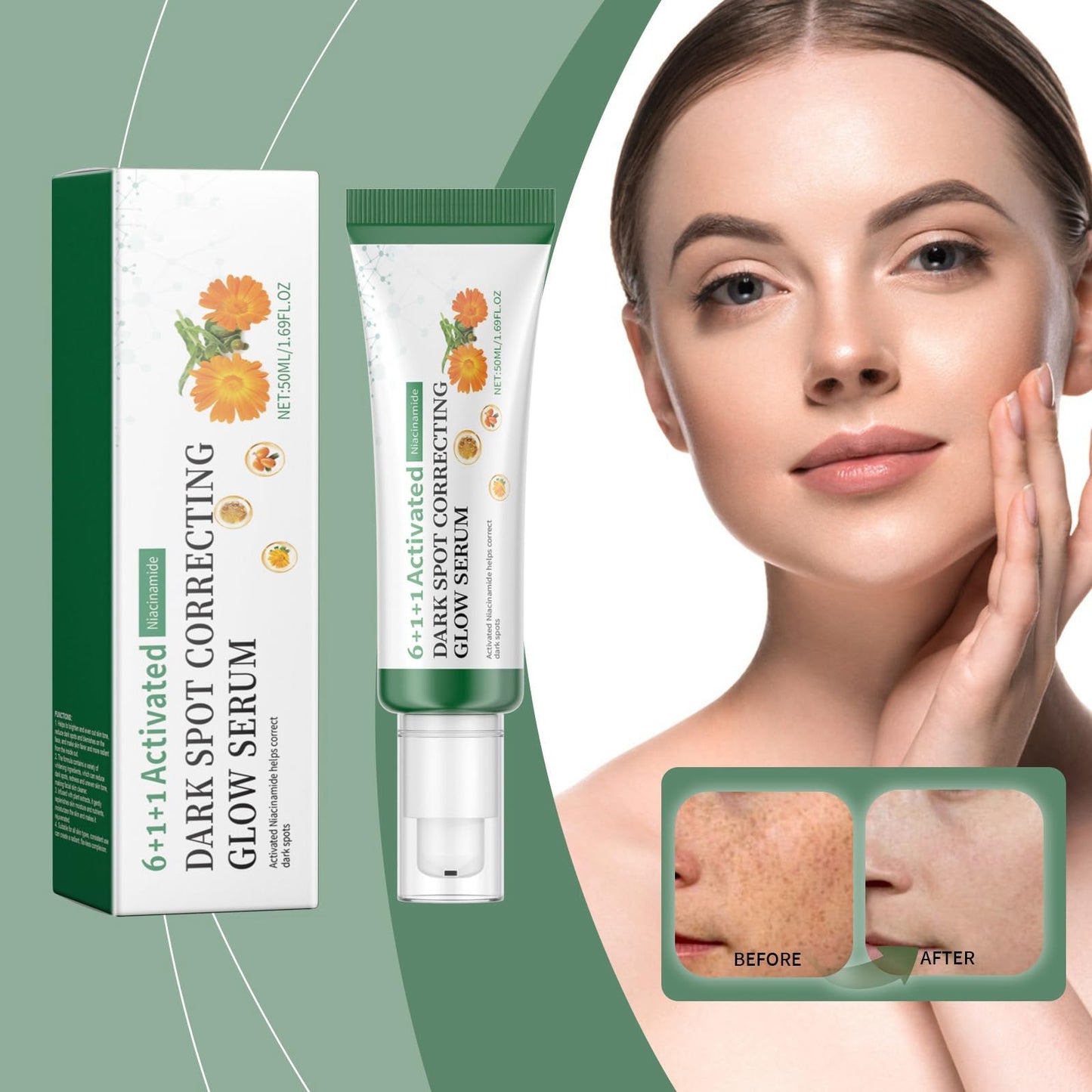 Siyinzu Dark Spot Correcting Glow Serum with 5% Niacinamide,Niacinamide Serum,Dark Spot Remover for Face,Skin Brightening Serums to Even Skin Tone,Dark Spots Correcting Serums,Face Serums Women,Facial Cream