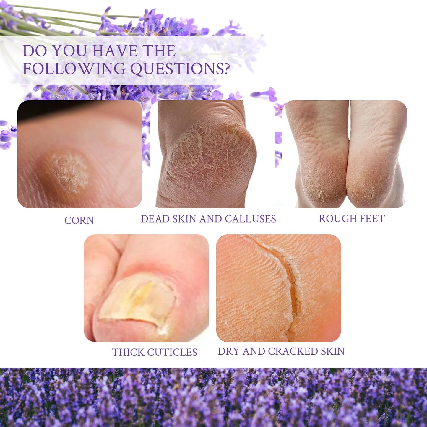MADGININE 6 Pairs Lavender Foot Mask Socks Sets,Foot Peel Mask for Hard Skin,Exfoliating Foot Peel Mask,Foot Peel Mask,Feet Peeling Mask,(Suitable for Cracked Heels,Dead Skin and Dry Skin)