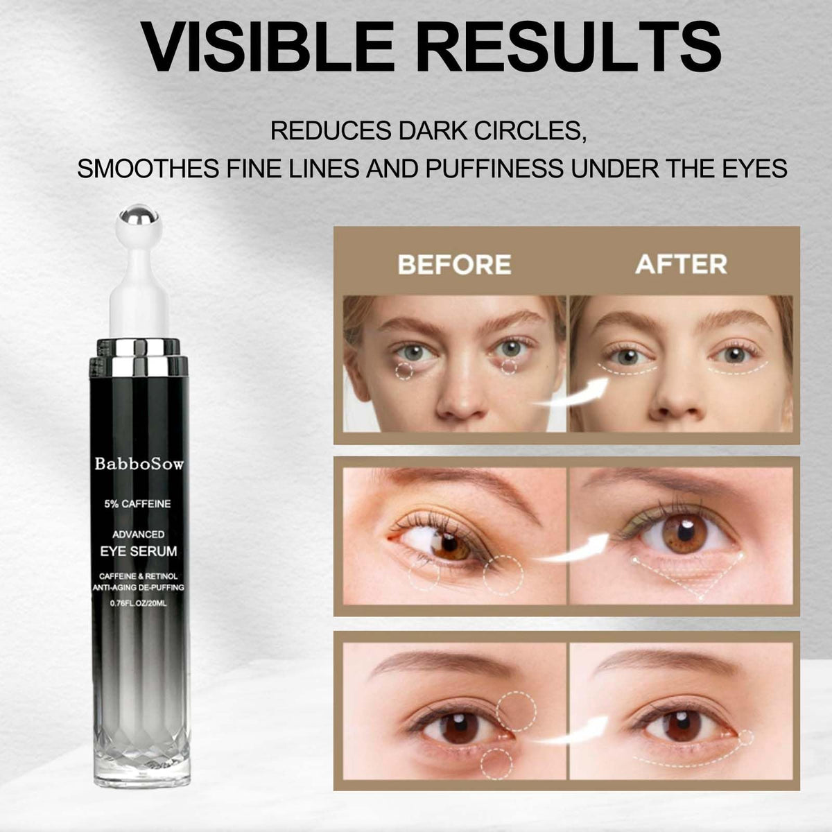 herlosfeel Caffeine Eye Cream, Caffeine Eye Serum,Under Eye Cream Dark Circles,Eye Cream for Dark Circles and Puffiness with 360° Roller, Anti-Ageing Reduces Puffiness, Wrinkles & Fine Lines