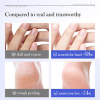 OKAQEE Urea Cream 42 Percent for Feet - Urea Foot Moisturiser with Salicylic Acid & Avocado Oil - Urea Foot Cream for Cracked Heels and Dry Skin - Foot Callus Remover Cream for Hard Skin - Fast Absorbing