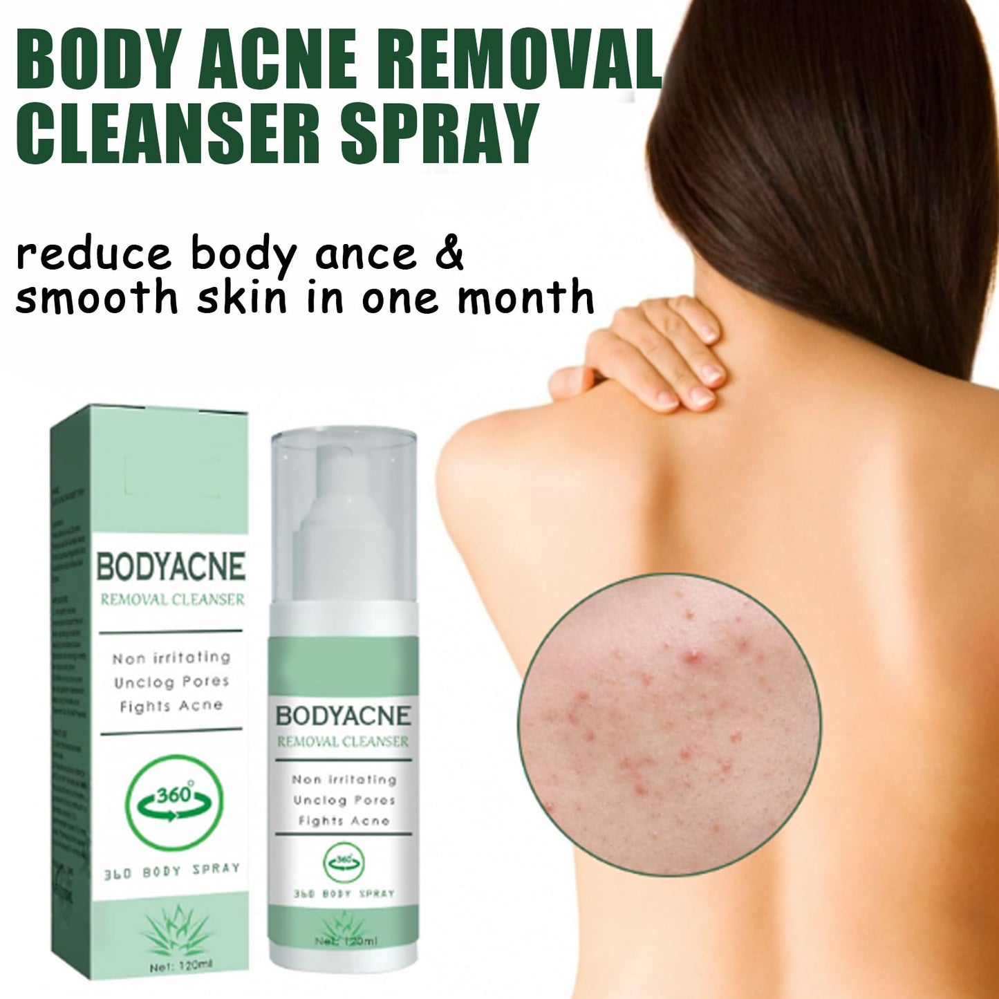 DMQ Acne Treatment Spary,Back Acne Treatment Serum,Body Moisturiser For Acne,Body Moisturiser For Dry Skin,Acne Moisturiser,Reduce Back Acne & Body Acne,Smoothing Moisturiser For Acne Prone Skin-120ml