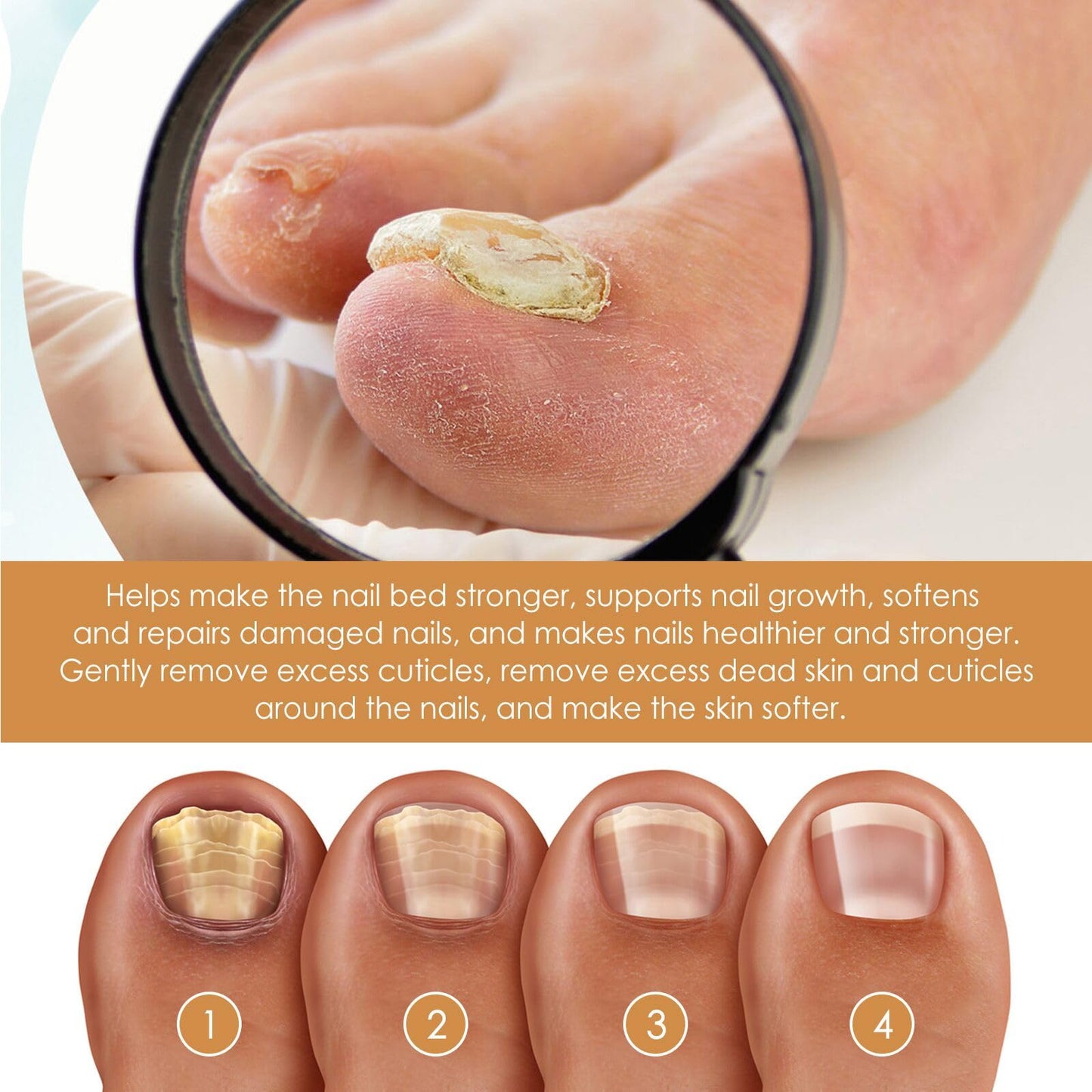 Nail Cuticle Remover Gel,Cuticle Remover Cream,Gentle Cuticle Remover,Instant Cuticle Care Gel,Cuticle Remover Gel,Nail Cuticle Repair Gel,Nail Cuticle Softener Moisturizing Gel