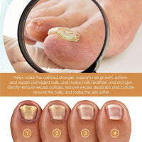 Nail Cuticle Remover Gel,Cuticle Remover Cream,Gentle Cuticle Remover,Instant Cuticle Care Gel,Cuticle Remover Gel,Nail Cuticle Repair Gel,Nail Cuticle Softener Moisturizing Gel