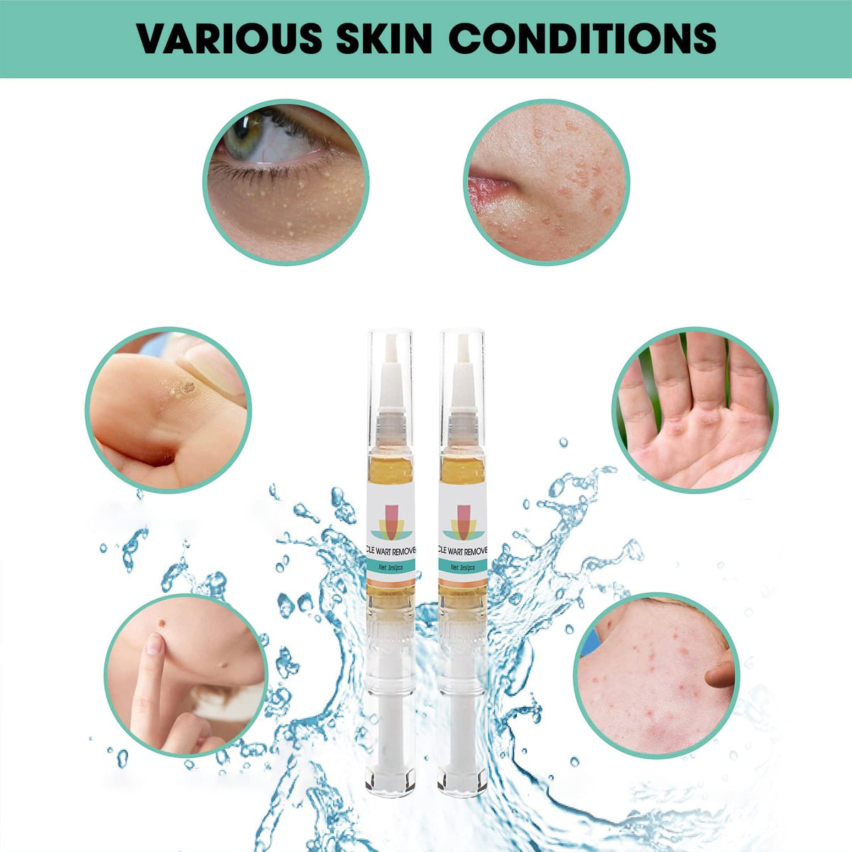 KATIX Wart Remover Fast-Acting and Effect - 2 Pen per Box Suitable for All Skin Types - 2-in-1 Wart & Verruca Treatment, Foot & Hand Wart Strong Remover - Natural & Safe Remover