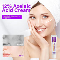2Pcs Azelaic Acid The Ordinary, Azelaic Acid Serum, 12% Azelaic Acid Azelaic Acid 20% Cream Face Skin Care Pigmentation Treatment for All Skin Types