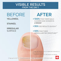 PODERM - Yellow & Damaged Nails - Improves the appearance of the nail - Clarifies, Smooths & Nourishes the nail - 100% Natural Ingredients - Professional hand/foot care | Easy & Fast | Swiss Made