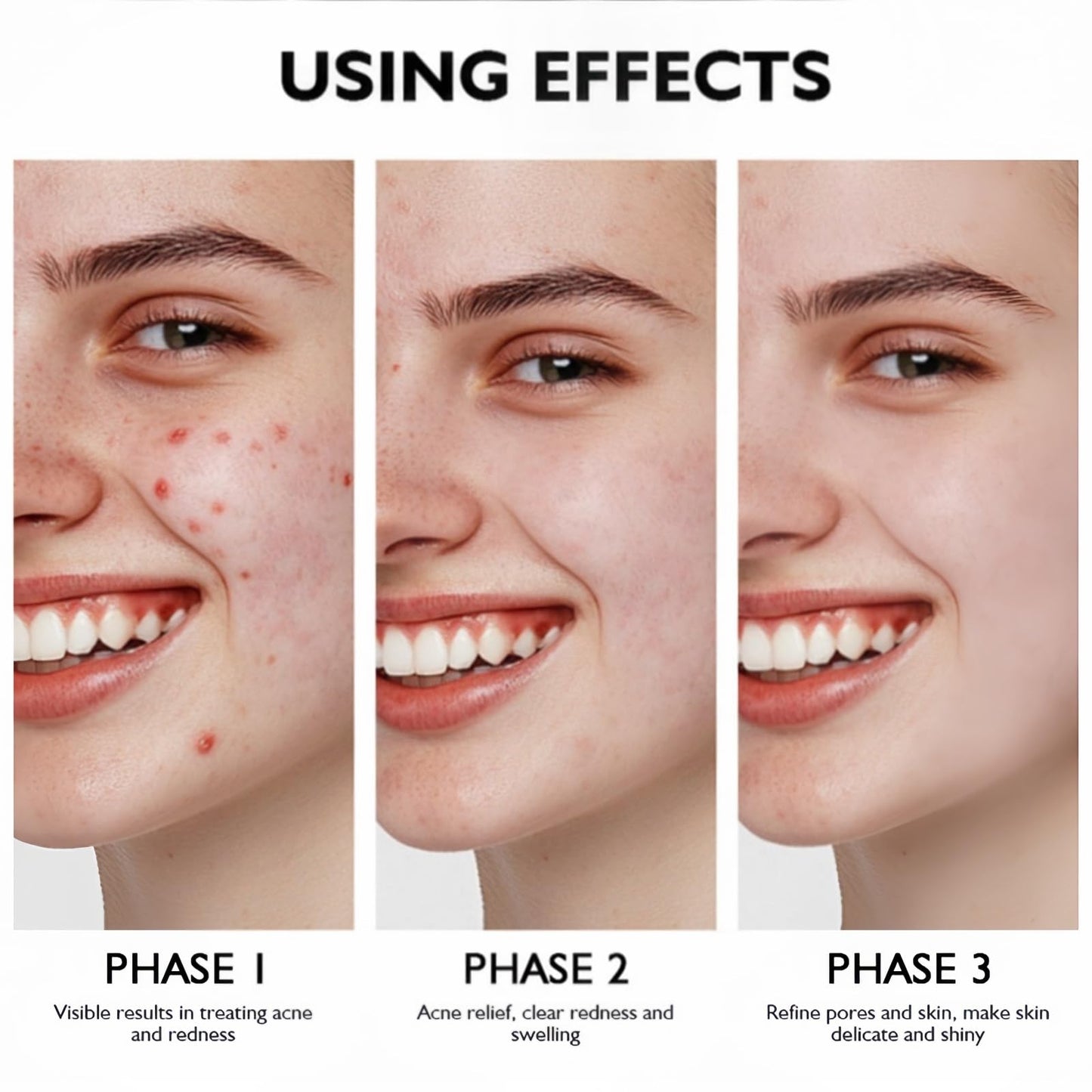 Oumun 10% Azlaic Acid Booster Cream Gel,Azlaic Acid Cream for Face,A/zlaic A/cid Cr/eam 10%,A-zlaic Ac-id Gel,Acne Treatment Cr-eam,Acne Cre-am,Skin Tightening Crea-m for Fa-ce,Azlai-c Aci-d Serum