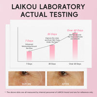 LAIKOU Sakura Eye Care Gift Set, 5-in-1 Eye Treatment Set with Serum, Cream, Day & Night Cream, Sleeping & Under Eye Mask for Dark Circles, Puffiness & Fine Lines, Day & Night Routine