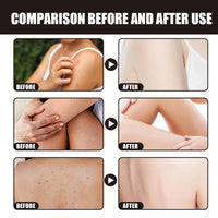 Oumun Colour Corrector Concealer,Leg Makeup Waterproof No Transfer,Leg Makeup Lotion,Leg Vein Cover up Makeup,Leg and Body Scar Cover up Makeup,Concealer Full Coverage,Makeup Concealer,Light Concealer,02#