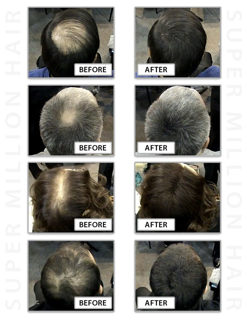 Super Million Hair 25g - No.23 Medium Brown by From the UK - Order by 2pm for next working day