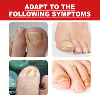 Fashion Base Ingrown Toenail Treatment Drop - Ingrown Toenail Treatment- Cuticle Care Oils for Ingrown Toenails - Trimming Toenail Softening Drops Natural Ingrown Toenail Correction Fungal Nail - 10ml