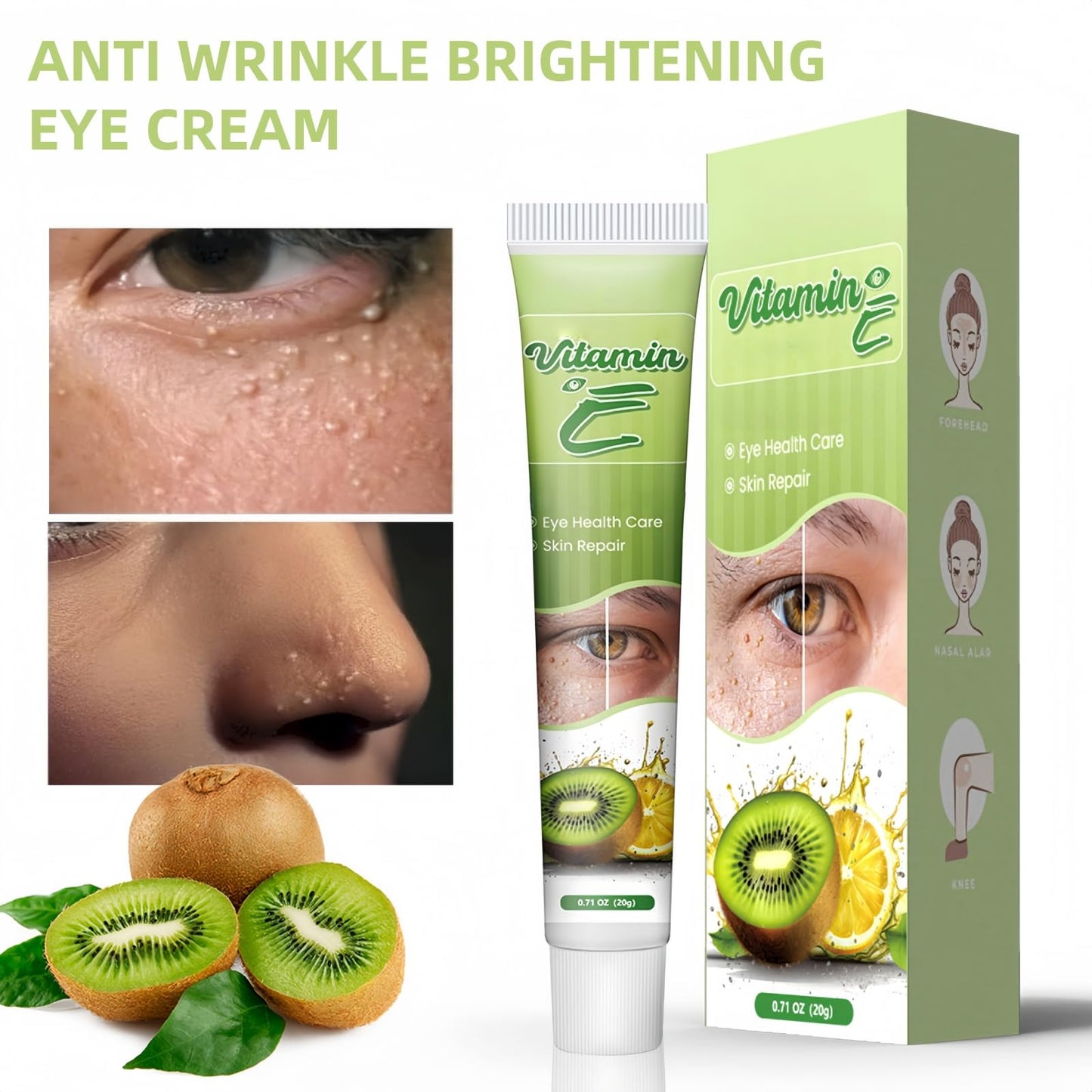 ShunJian Milia Remover, Milia Removal Cream & Brightening Eye Cream, Relieves Fat Par/ticles & Bumps, Milia Treatment for Eye & Face, Wrinkles Remover & Dark Circles Treatment, Firming & Moisturizing