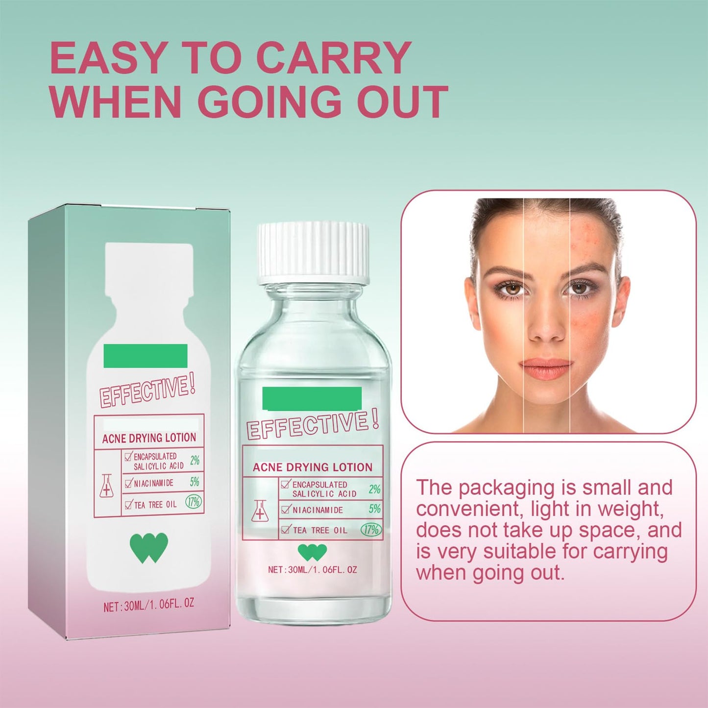 Overnight Drying Lotion, Spot Treatment for Acne, Anti-Blemish Drying Lotion For Blemishes 30ml Anti Acne Treatment Face Serum for Facial Pimples/Zits, Acne Control, Reduce Redness