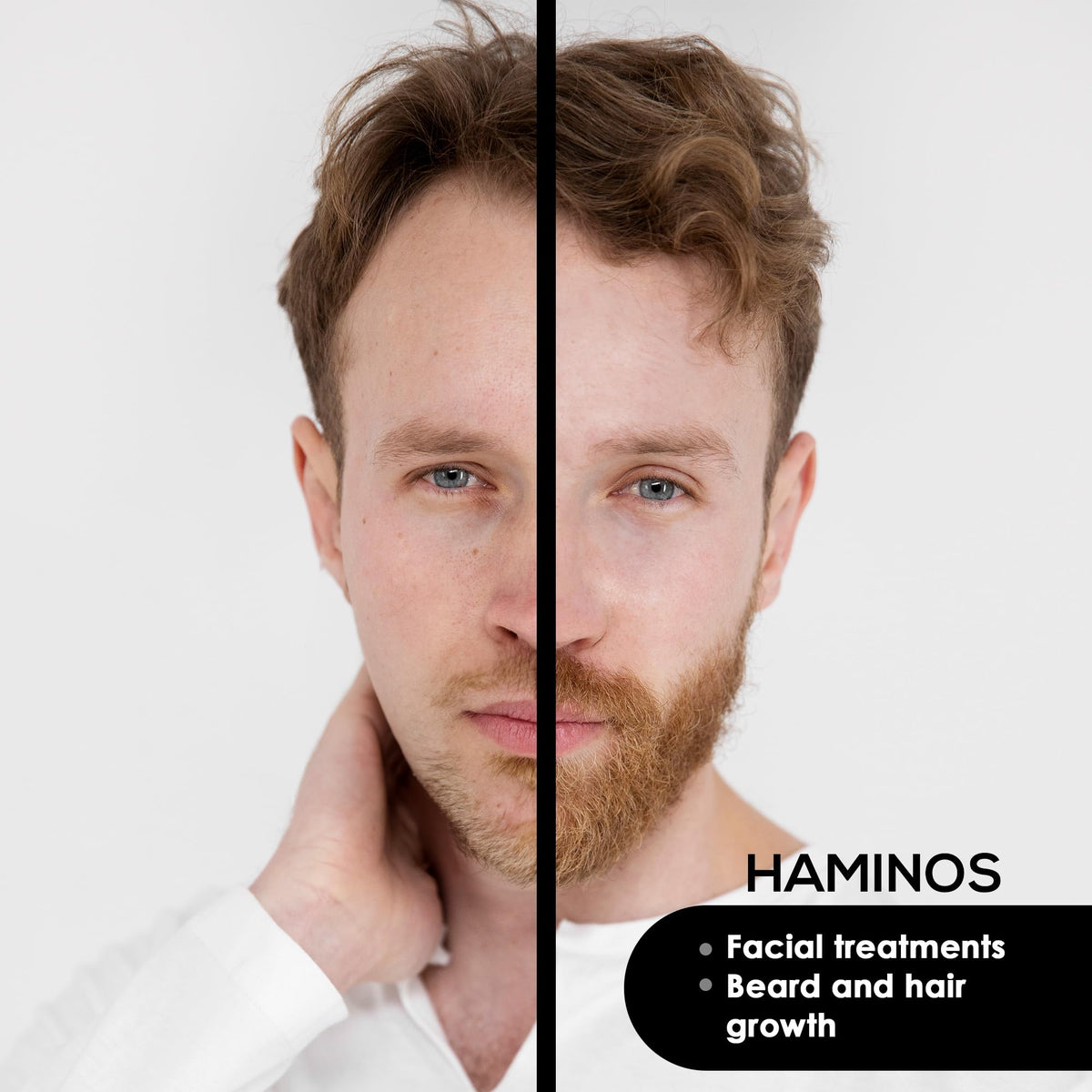 HAMINOS Head 0.5 mm compatible with HAMINOS Derma Roller, 105 Titanium Needles