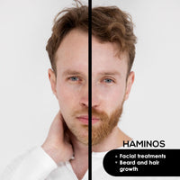 HAMINOS Head 0.5 mm compatible with HAMINOS Derma Roller, 105 Titanium Needles