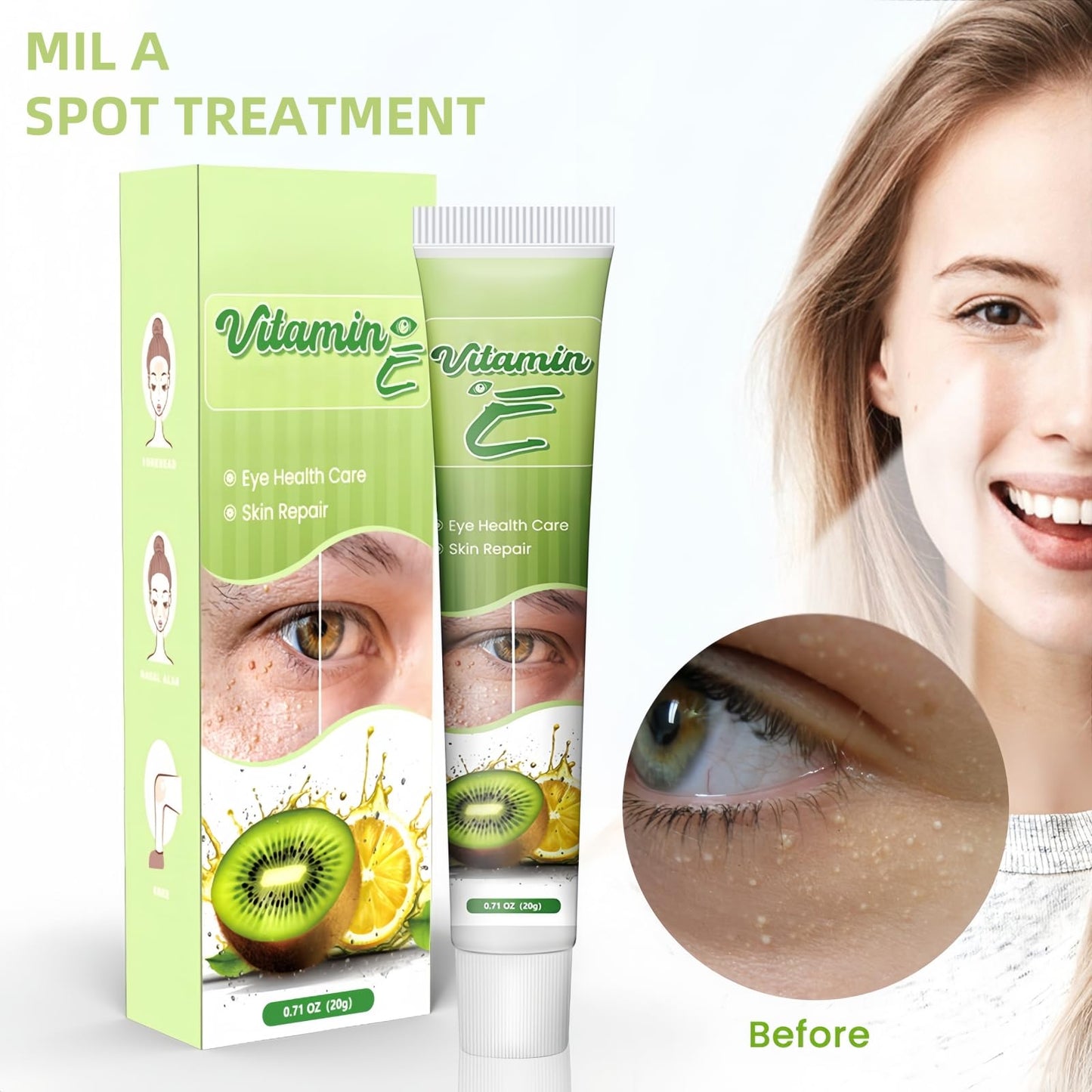 ShunJian Milia Remover, Milia Removal Cream & Brightening Eye Cream, Relieves Fat Par/ticles & Bumps, Milia Treatment for Eye & Face, Wrinkles Remover & Dark Circles Treatment, Firming & Moisturizing