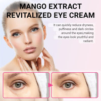 2 PCS Mango Revitalize Eye Cream Mango Activating and Firming Eye Cream Helps Remove Eye Bags and Dark Circles Deeply Moisturizes and Hydrates Firming Skin