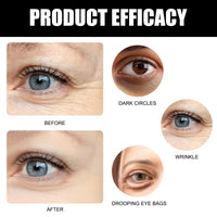 Liameph Castor Oil and Frankincense Roller Ball, Castor Oil Eye Roller Time Eraser Eye Care Products for Under Eye Area Lifts Firming(1pc, 10ml)