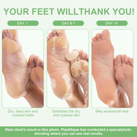 Foot Peel Mask for Hard Skin, 4 Pairs Foot Exfoliating Socks, Moisturizing Foot Care for Callus Remover, Cracked Heel, Dead & Dry Skin - Baby Soft Smooth Touch Feet(Aloe Vera)