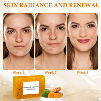 Nadiaen Turmeric Soap Handmade Turmeric Granular Soap Bar for Acne and Dark Spots Turmeric Soap for Face Natural Organic Turmeric Soap for Face & Body Deep Cleaning Moisturizing Erase Fine Lines Firm Pore