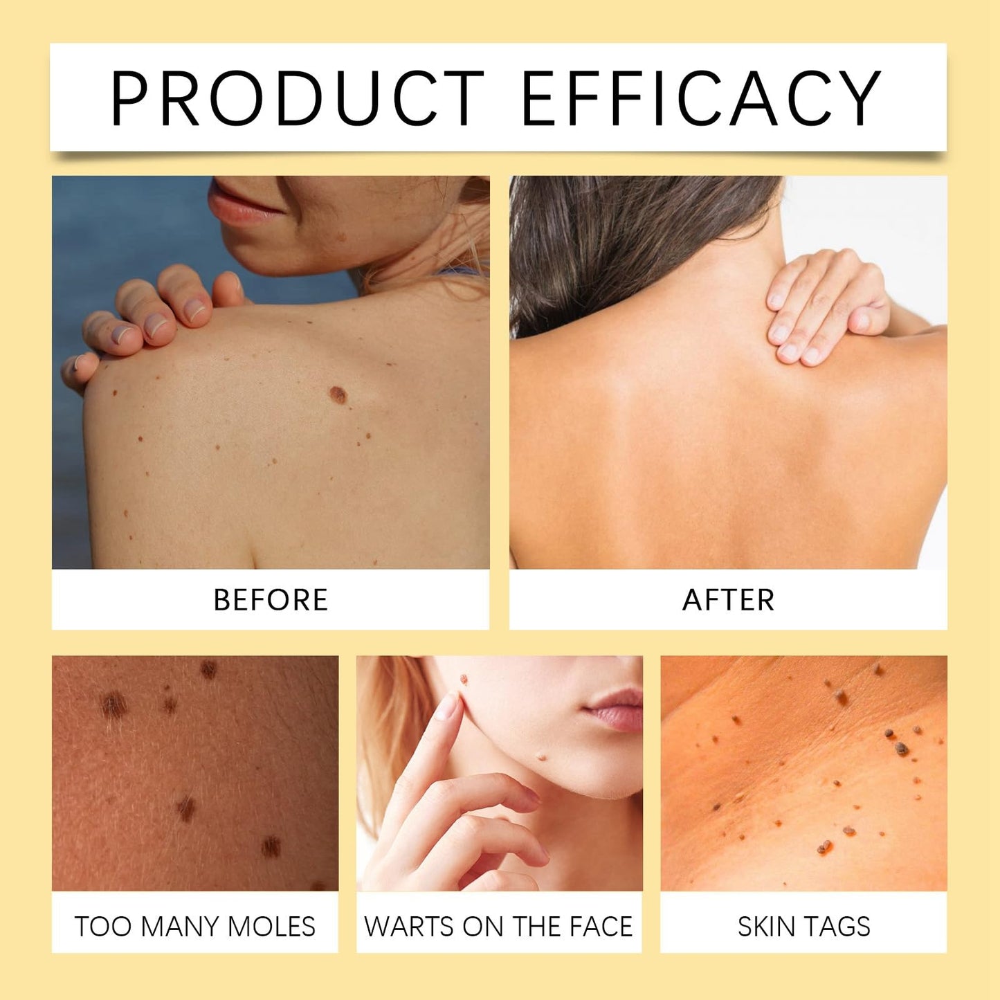 BigyQiu Bee V-enom Treatment Cream,Bee V-enom Repair Cream,Bee V-enom Cream,Bee V-enom Removal Treatment Cream,Bee V-enom Removal&Treatment Cream for All Skin Types,Hydrating Cream for Men Women