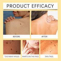 BigyQiu Bee V-enom Treatment Cream,Bee V-enom Repair Cream,Bee V-enom Cream,Bee V-enom Removal Treatment Cream,Bee V-enom Removal&Treatment Cream for All Skin Types,Hydrating Cream for Men Women