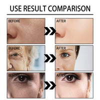 Snail Mucin Repair Cream,Advanced Snail 92 All in one Cream,Snail Cream,Snail Secretion Moisturizer,Snail Collagen Lifting & Firming Cream,Facial Repair Whitening Brightening Serum 100g