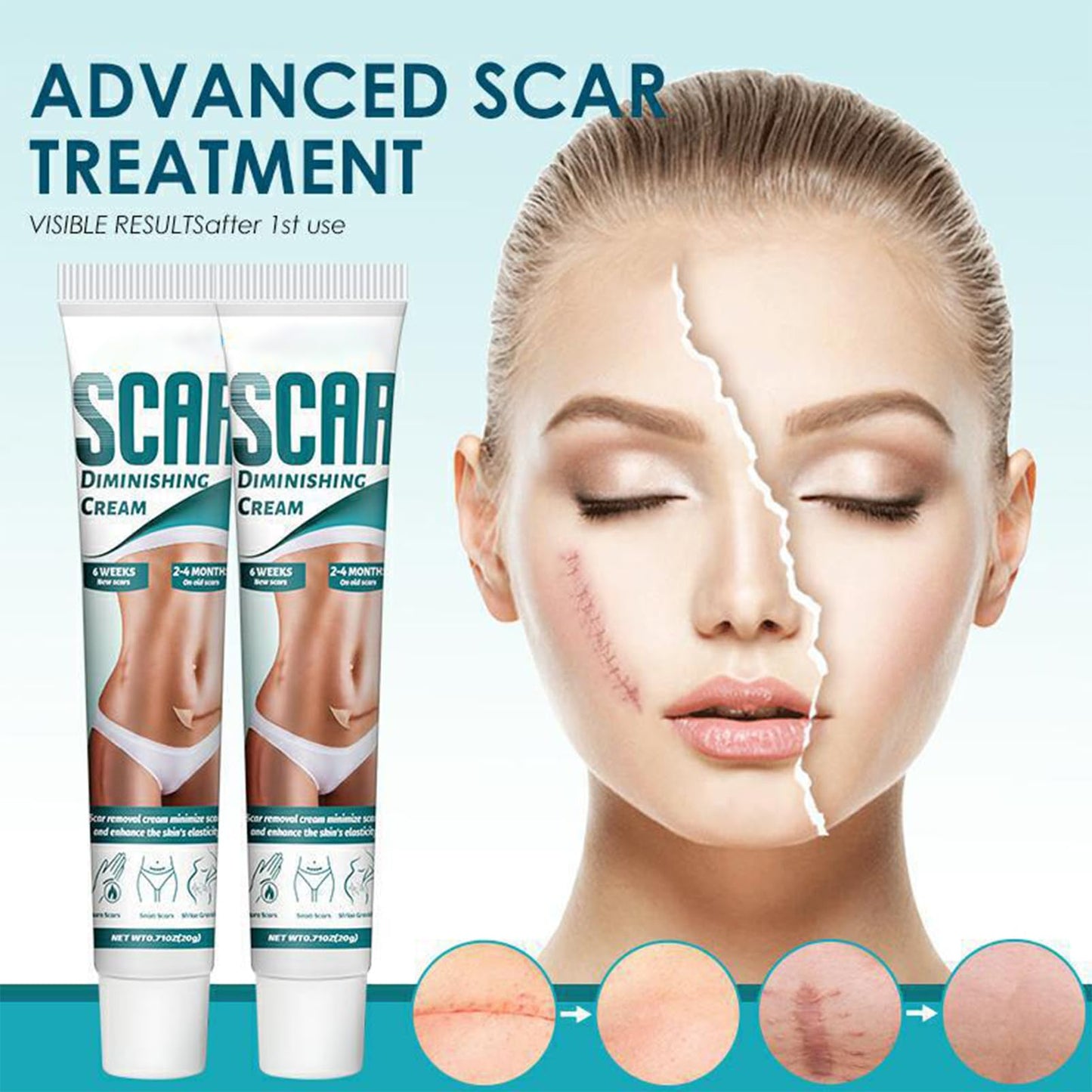 Scar Cream, Scar Removal Cream, Stretch Mark Removal Cream, Scar Erase, Skin Repair Cream for Face & Body Scar, for C-Section, Burns, Stretch Marks, Acne, Surgery, Effective for Both Old and New Scars
