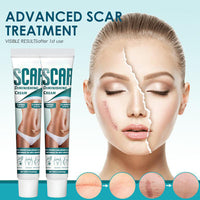 Scar Cream, Scar Removal Cream, Stretch Mark Removal Cream, Scar Erase, Skin Repair Cream for Face & Body Scar, for C-Section, Burns, Stretch Marks, Acne, Surgery, Effective for Both Old and New Scars