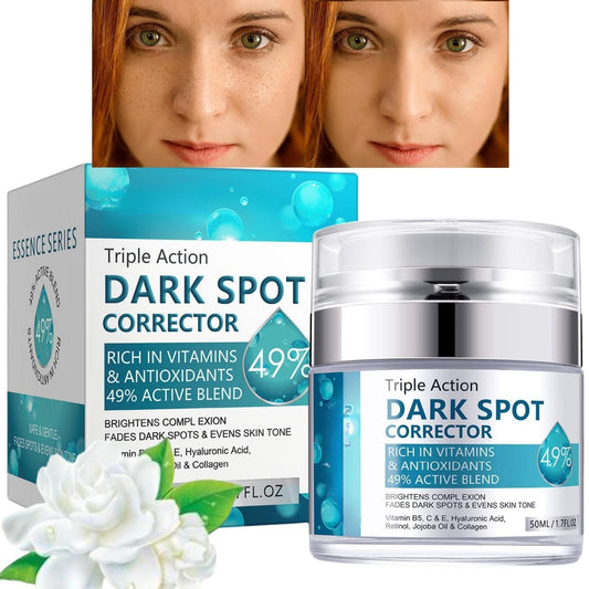 SingHao Dark Spot Remover for Face&Body,Dark Spot Correcting Cream,Dar/k Sp/ot Remover,Pigmentation Removal,Da/rk Spo/t Corrector Cream,Freckle Removel Crea/m,Hyperpigmentation Treatment Mela-Sma Cr/eam