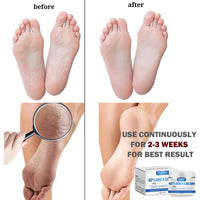 Urea 42% Foot Cream, Cracked Heel Repair Cream For Feet and Hand, Callus Remover For Dry And Hard Skin, Maximum Strength for Hand, Foot and Body Care, 100g (Original Scent)