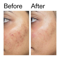 The INKEY List Ectoin Hydro-Barrier Serum 30ml, Advanced Dual-Action Serum, Boosts Hydration, Builds Stronger Skin Barrier, Lightweight Texture