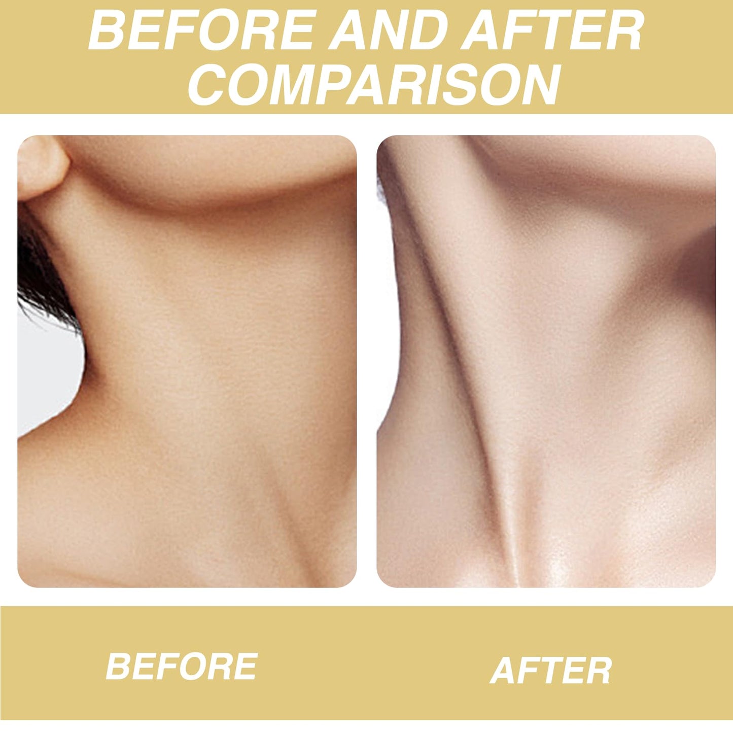 Ninnyi Neck Firming Cream, AH 8 Firming Neck Cream with Double Roller Massage, Reduce Wrinkles Fine Lines and Double Chin, Firm and Lift Sagging Skin