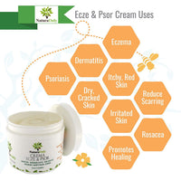 Eczema & Psoriasis Cream Natura Only, For Dry, Irritated Skin, Itch Relief, Dermatitis, Rosacea. Natural 15-in-1 Formula Promotes Healing and Calms Redness, Rash and Itching Fast