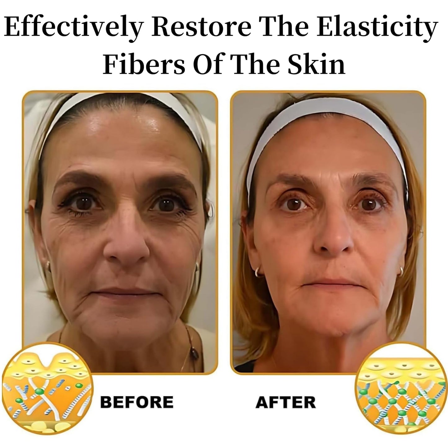 Bee Ven-om Skin Treatment Cream,Been Ven-om Cream,Be-e Ve-mom Cr-eam For Wrinkles,Skin Firming Tightening Lotion,Multi Purpose Lotion,Relieve Skin Itchiness,Soften And Nourish,Hydrate And Moisturize