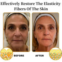 Bee Ven-om Skin Treatment Cream,Been Ven-om Cream,Be-e Ve-mom Cr-eam For Wrinkles,Skin Firming Tightening Lotion,Multi Purpose Lotion,Relieve Skin Itchiness,Soften And Nourish,Hydrate And Moisturize