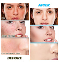 Tioueo Kojic Acid and Turmeric Cleansing Pads - 60pcs Brightening and Exfoliating Pads for Smooth, Radiant Skin