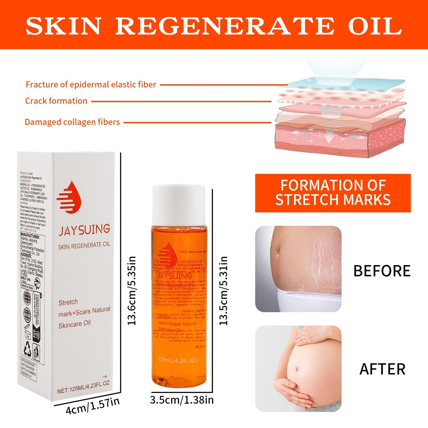 PlusBee Bio Oil Scar Treatment, Collagen Boosting Oil for Scars, Stretch Marks & Uneven Skin Tone, Skincare Serum for Pregnancy, Acne & Surgery Scars, 125ml