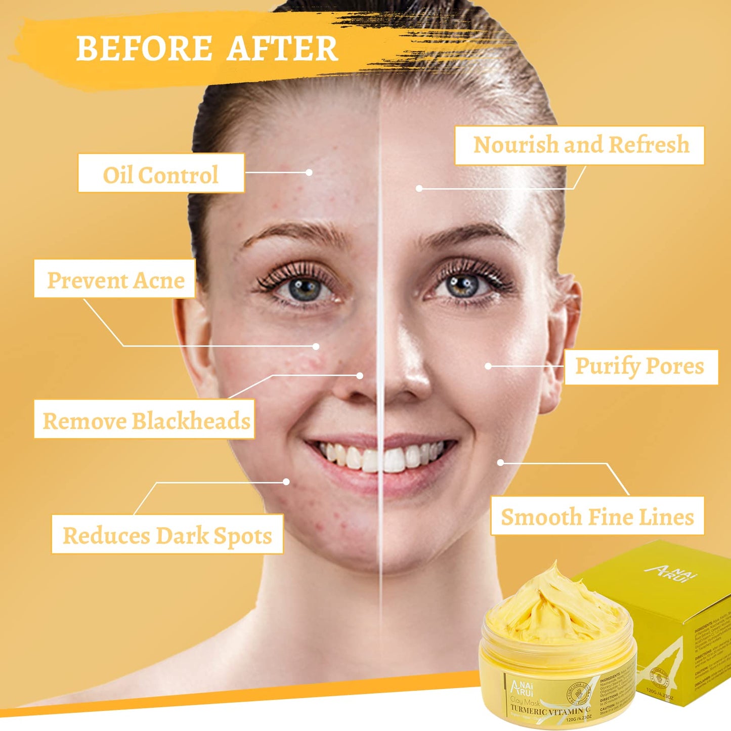 ANAiRUi Turmeric Vitamin C Clay Mask With Turmeric, Vitamin C and Kaolin clay, for Deeply Cleansing and Hydrating, Reduce Acne, Dark Spots, Blackheads, and Pores, Skincare Mask, 120g