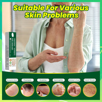 Athlete's foot Treatment cream - anti fungal foot cream for dry Feet, cracked heel Treatment & Athletes foot cream extra strong