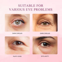 Ninnyi Mango Revitalize Eye Cream, Hyaluronic Acid Repair Cream, Mango Activating and Firming Eye Cream, Removes Eye Bags & Dark Circles