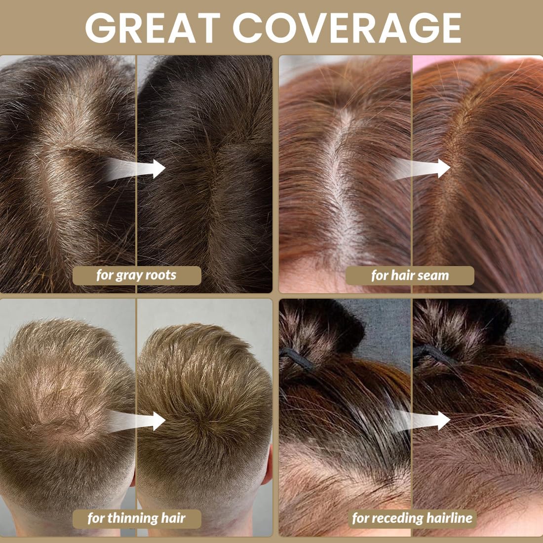 VOLLUCK Root Touch Up Hair Powder, Root Cover Up Hairline Shadow Powder for Thinning Hair for Women and Men, Bald Spots, Eyebrows, Beard Line (Auburn)