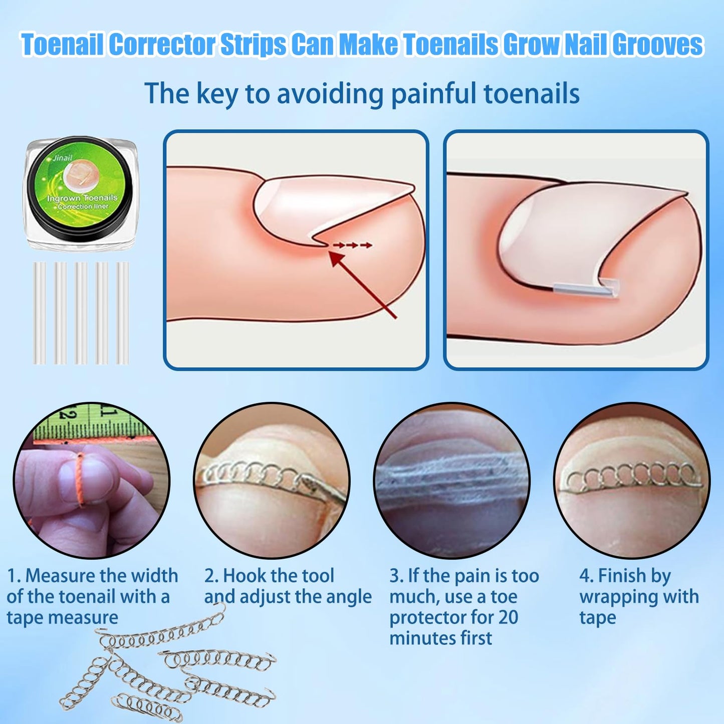 Professional Ingrown Toenail Treatment Kit, Podiatry Tools with Corrector Braces,Nail File and Lifter,Pain Relief Patches,Curved Toenail Corrector for Women Men