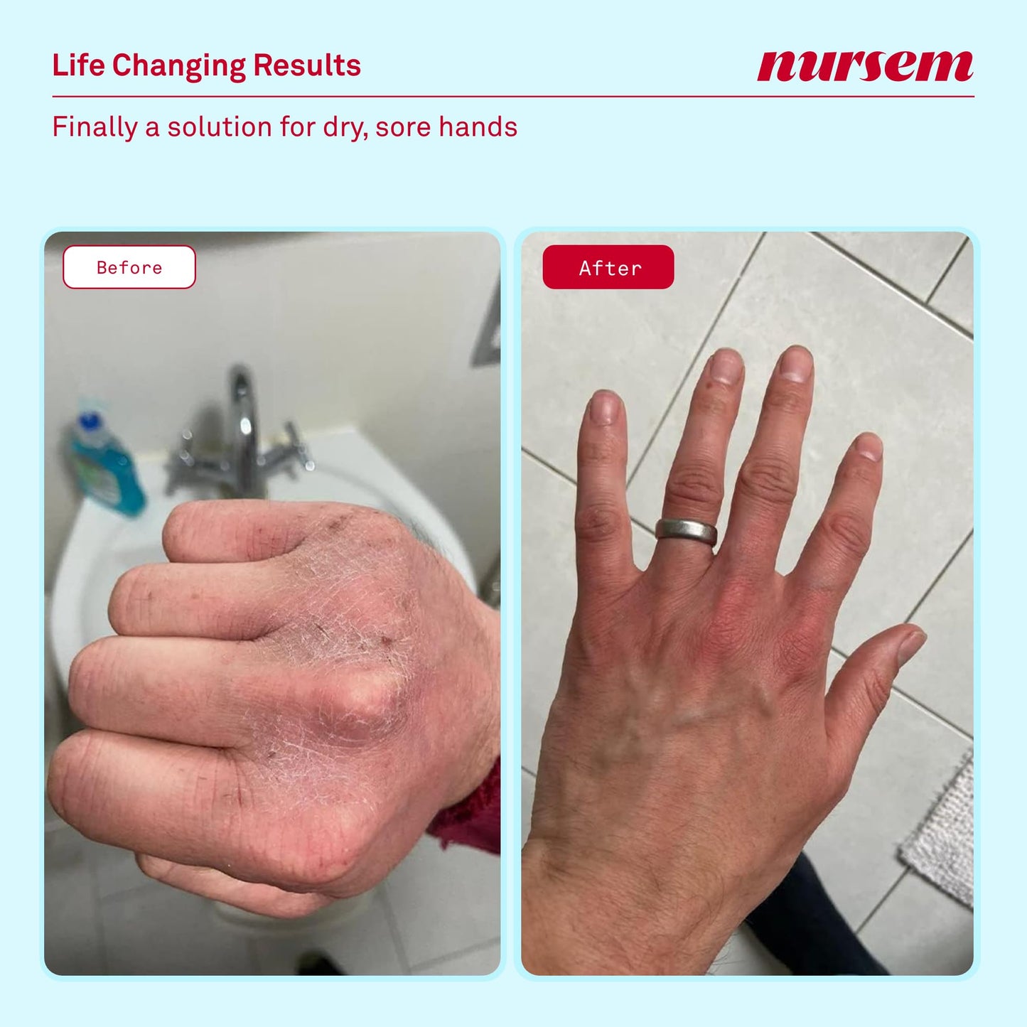 Nursem CARING HAND WASH – 300ml | Natural, ultra-gentle soap-free formula for very dry hands