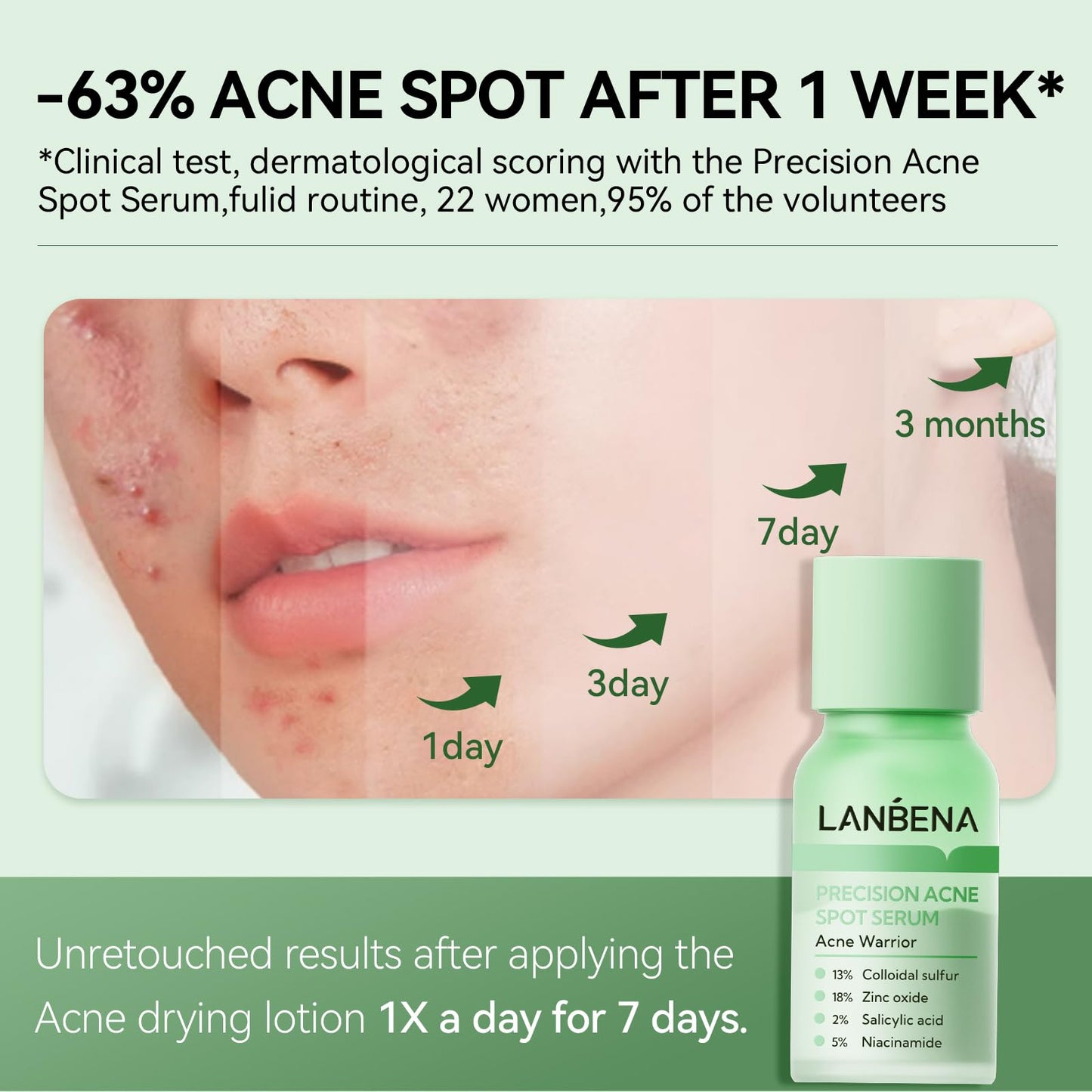 LANBENA Precision Acne Treatment Spot Serum, Drying Lotion, Overnight Acne Treatment For Face, Dry Out Pimples, Blemishes, Zits And Clean Pores, 0.42 Fl Oz (Pack of 1)