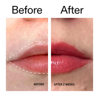 The INKEY List The Inkey List Tripeptide Plumping Lip Balm 10ml, Clinically Proven Plumping Tinted Lip Care, Hydrates Dry Cracked Lips, Vegan & Cruelty Free, Berry Tint