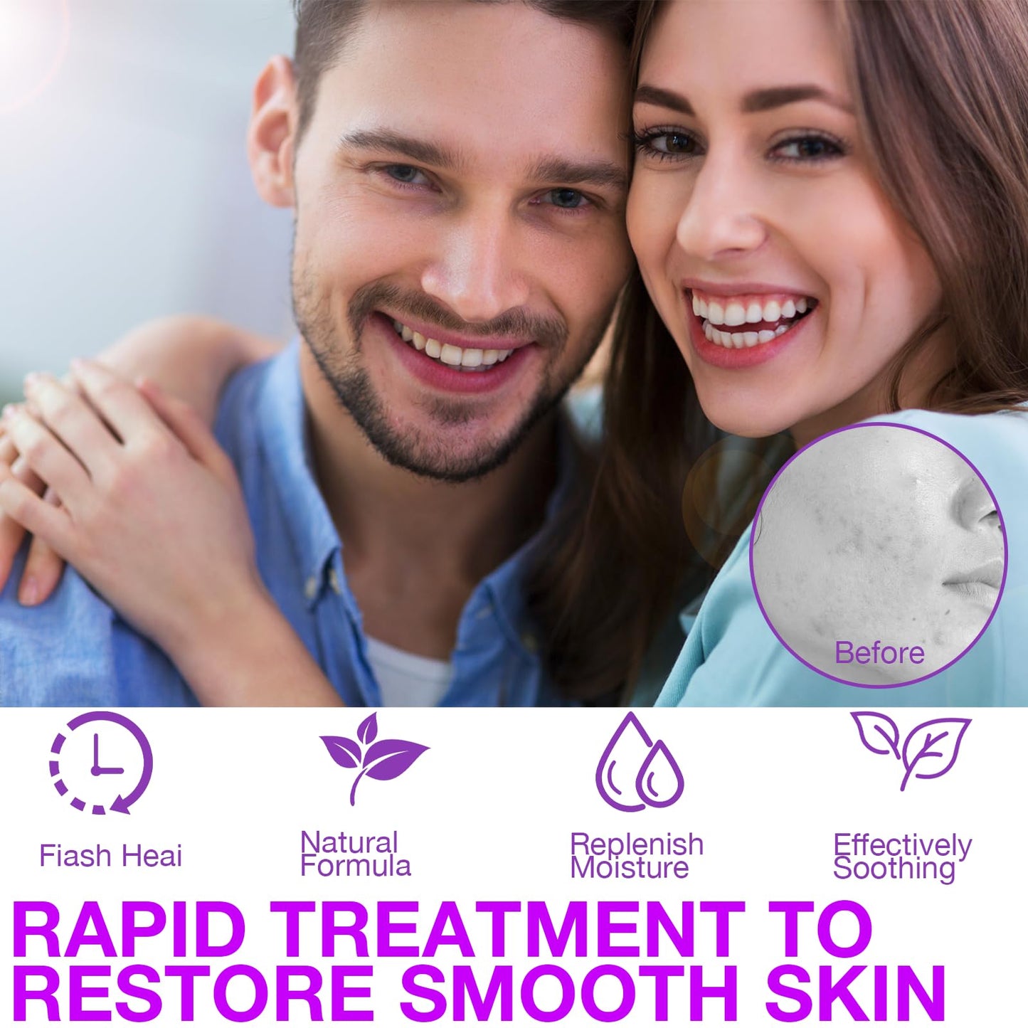 XdealCozyxc 2 PCS The Ordinary Azelaic Acid Serum, Azelaic Acid Cream Brightening Face Skin Care Pigmentation Treatment for All Skin Types